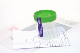 实验室尿液杯进行药物测试